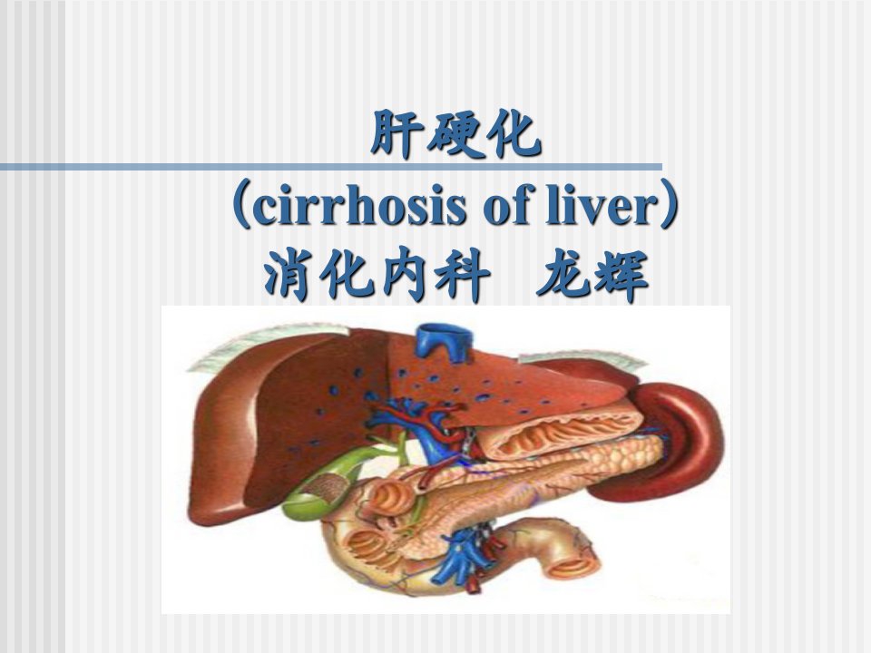 肝硬化消化内科ppt课件