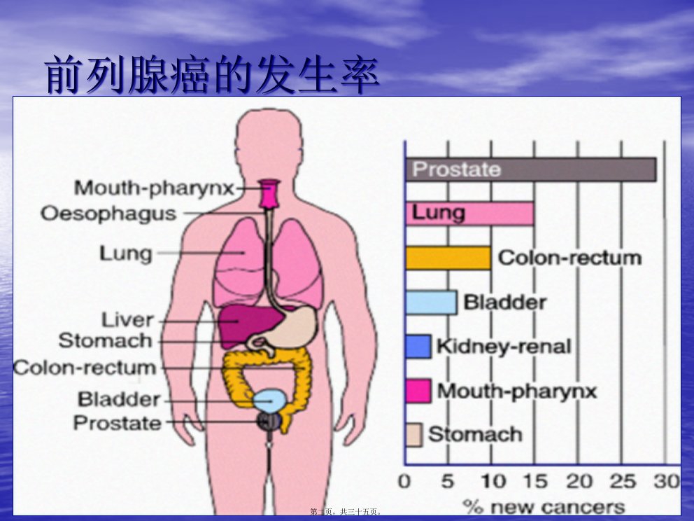 前列腺癌诊治进展