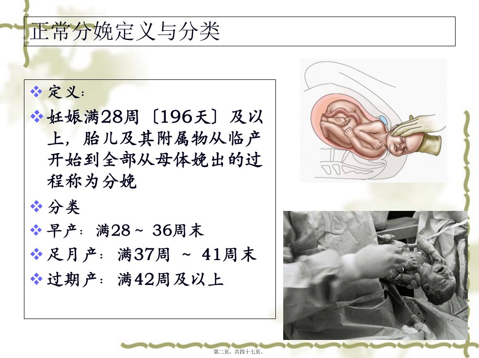 产程观察与处理