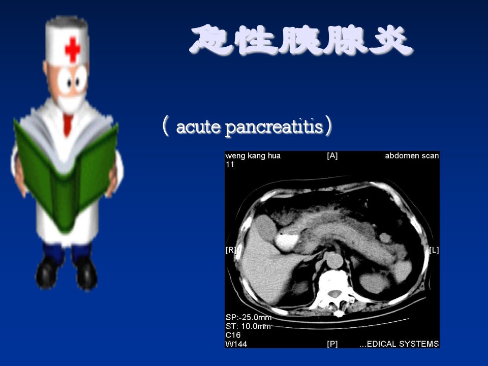 21急性胰腺炎