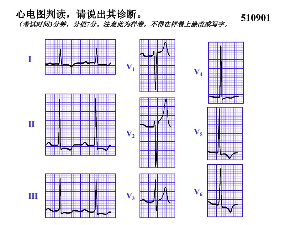 执业医师实践技能考核(三)心电图试题集