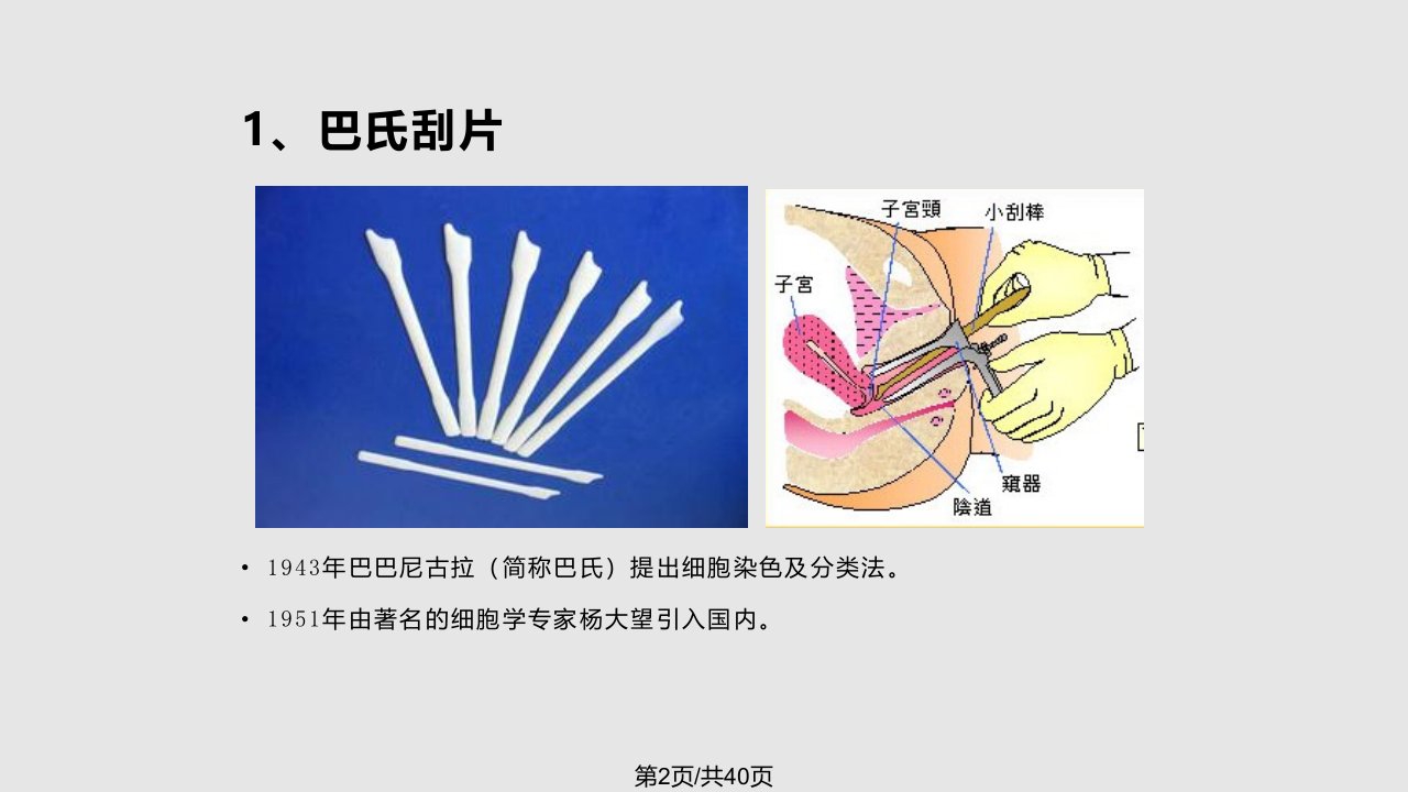 TCT液基细胞学诊断技术