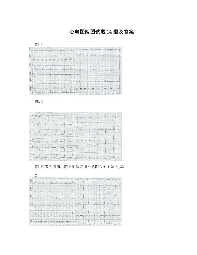 心电图阅图试题14题及答案