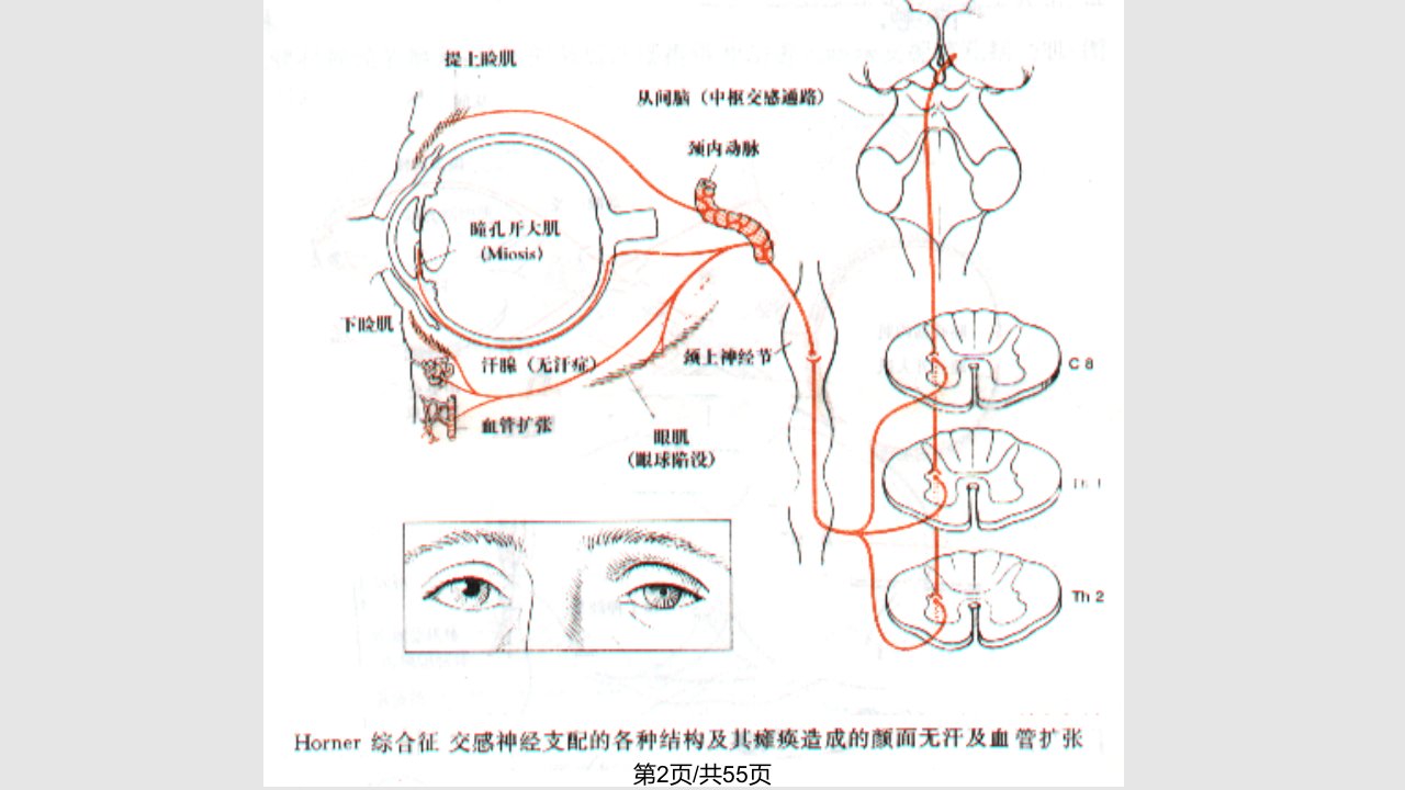 神经病学总论78