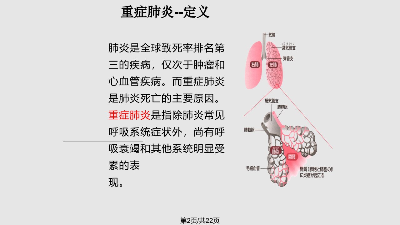 重症肺炎护理个案