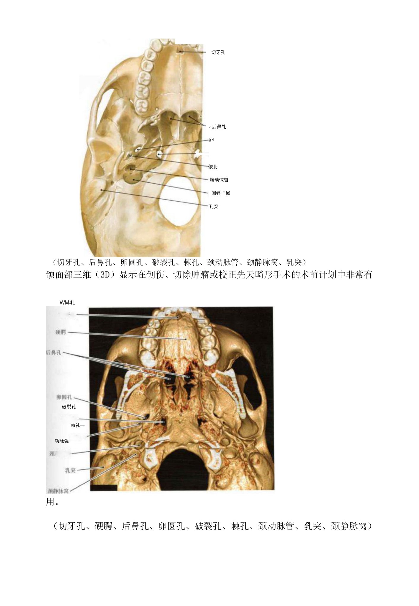 颅骨解剖及CT三维重建