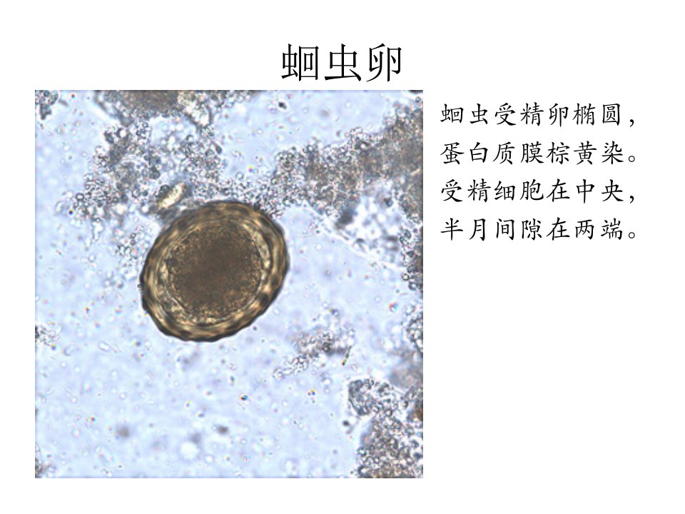 寄生虫学虫卵经典总结及图片