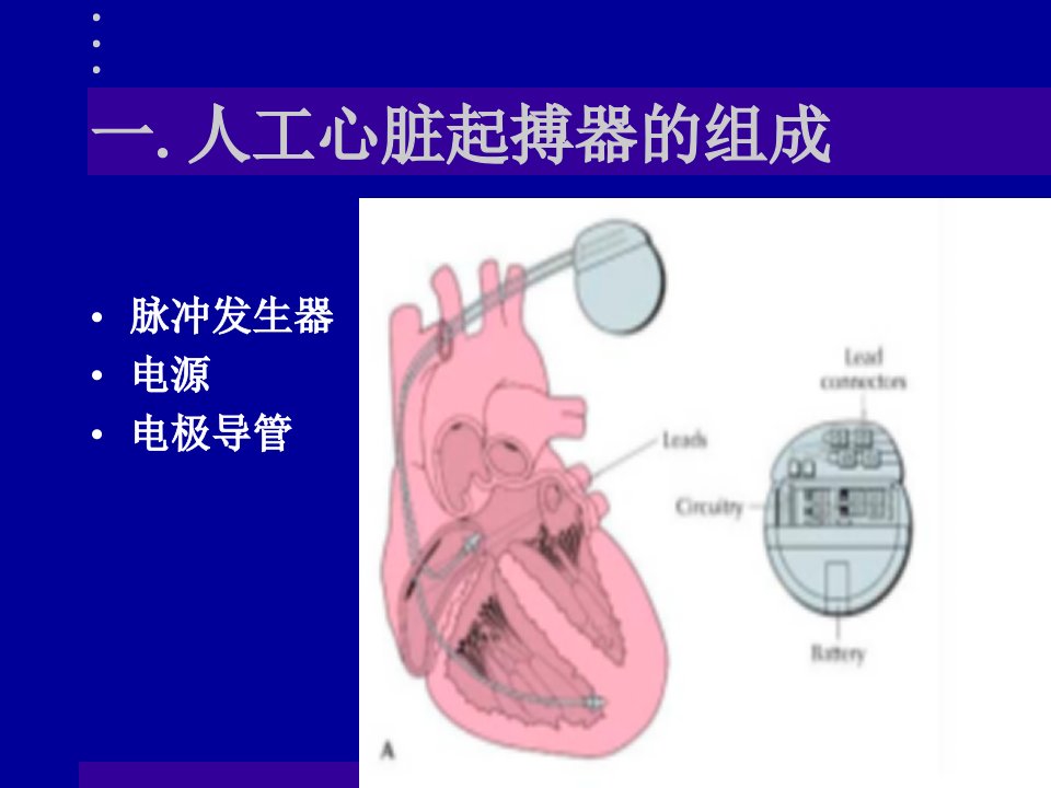 人工心脏起搏