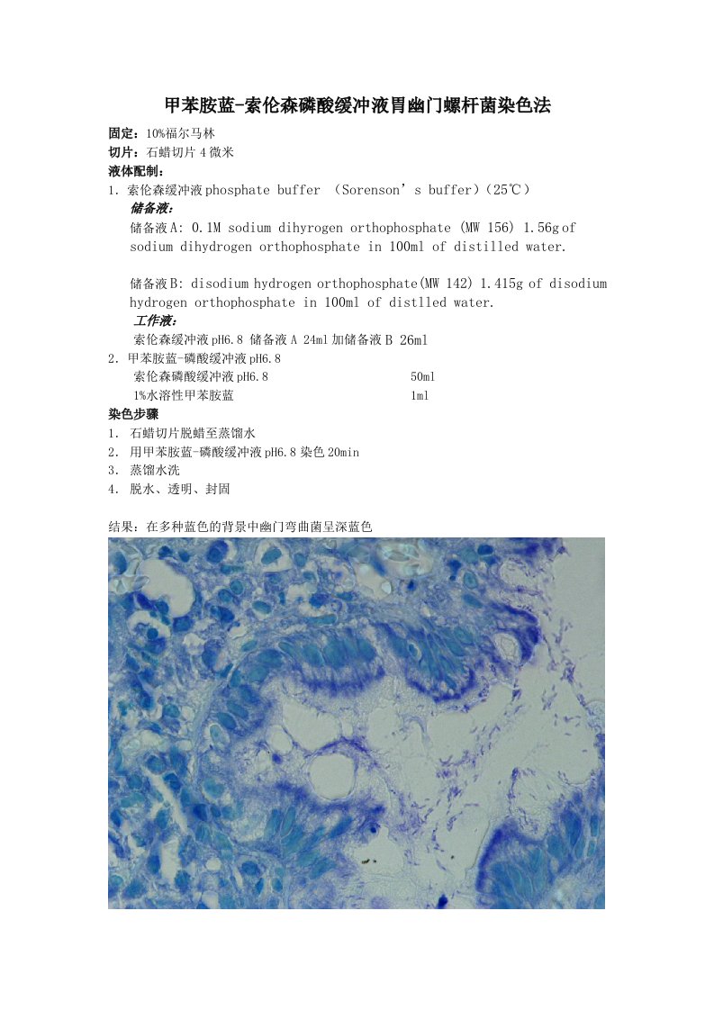 甲苯胺蓝索伦森磷酸缓冲液胃幽门螺杆菌染色法