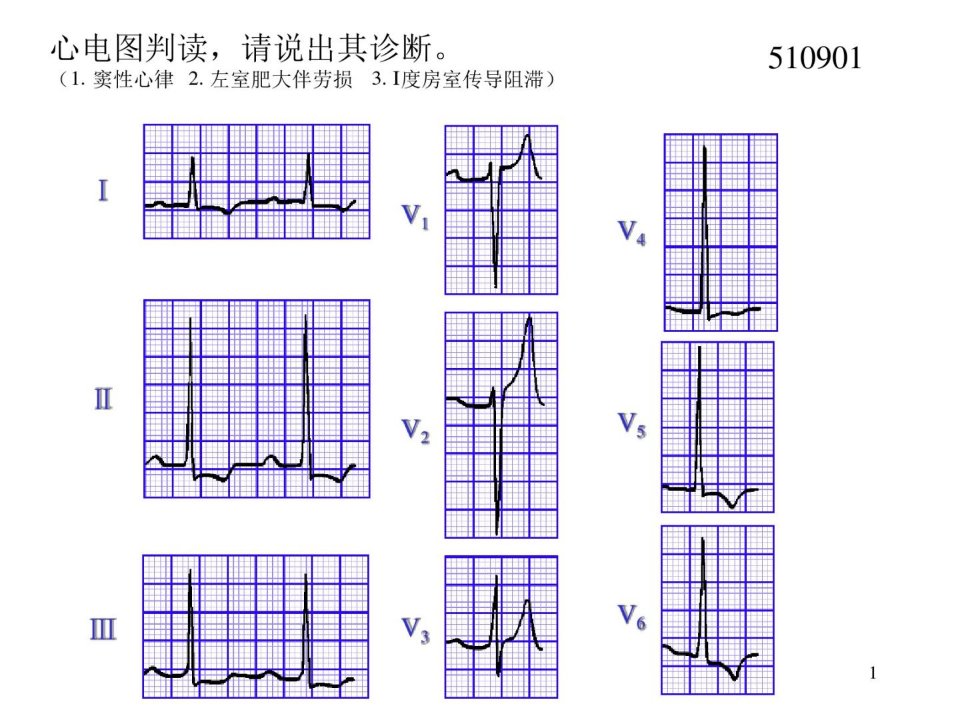 心电图试题及答案参考资料