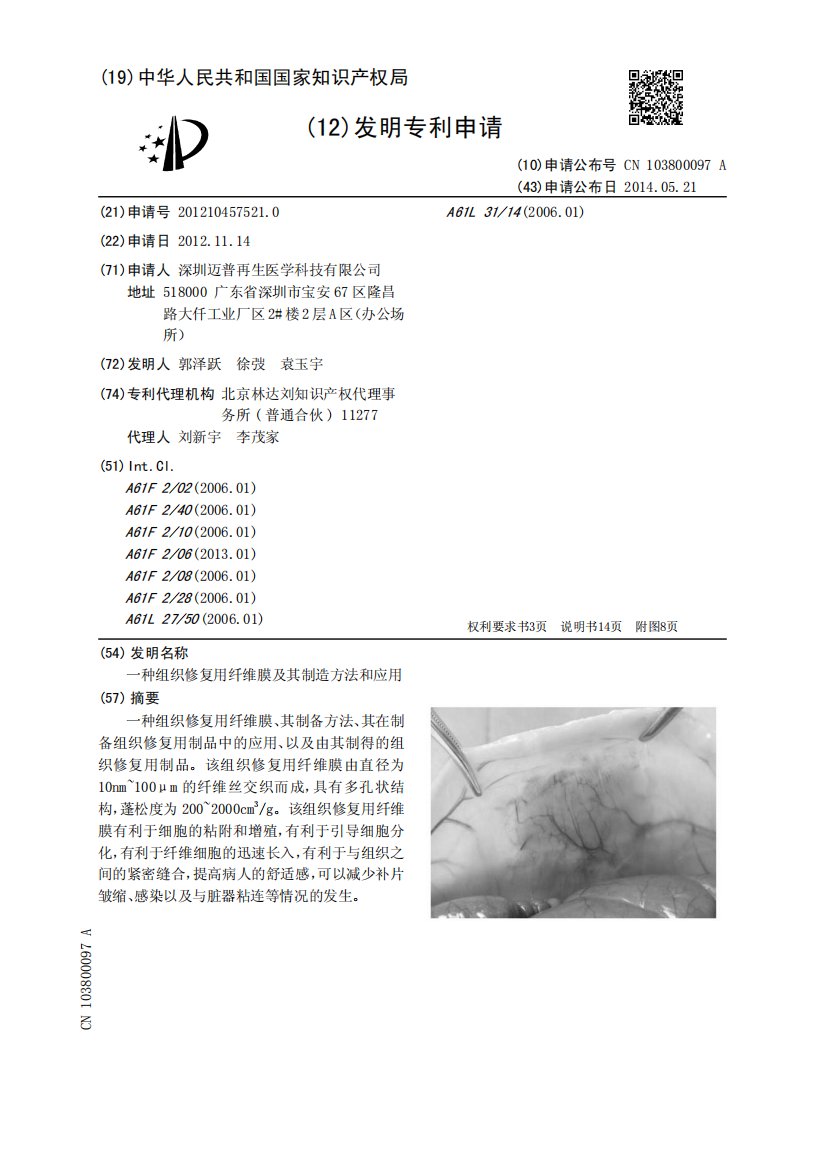 一种组织修复用纤维膜及其制造方法和应用