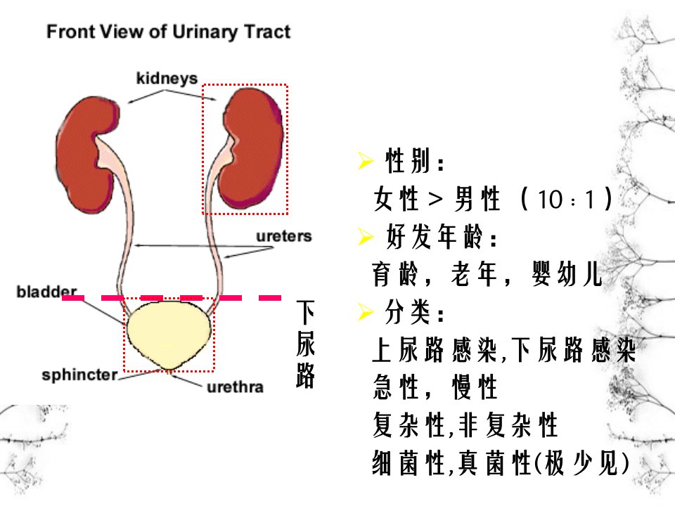 尿路感染病因和发病机制