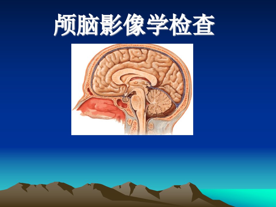 颅脑影像学检查