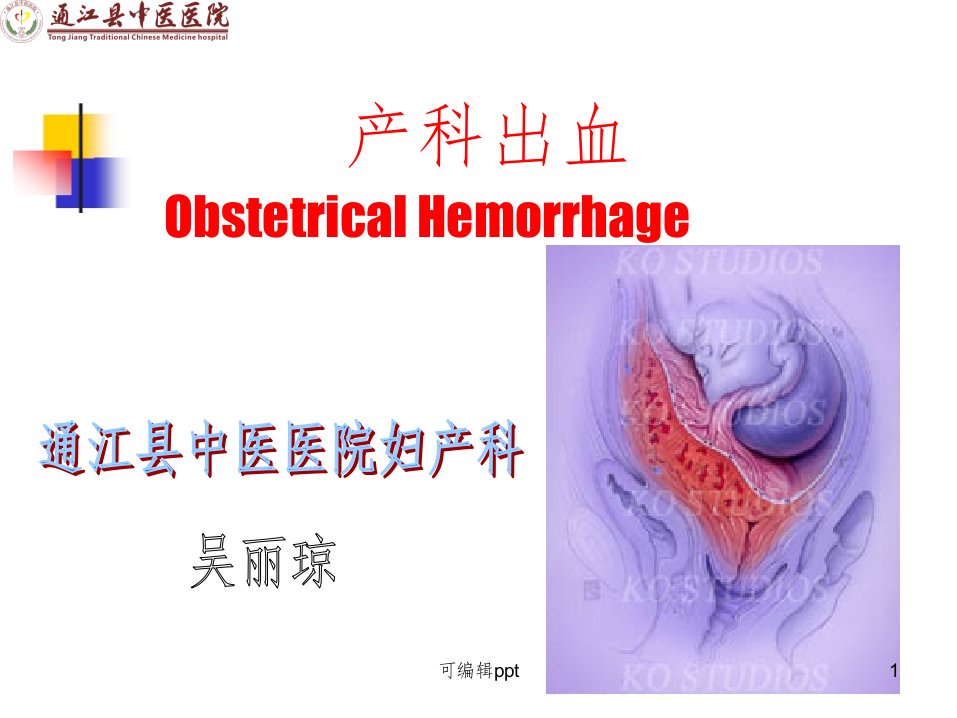 妇产科之产科出血ppt课件