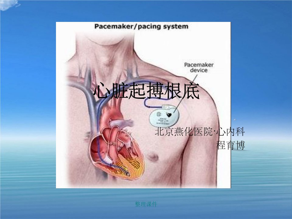 《心脏起搏基础》
