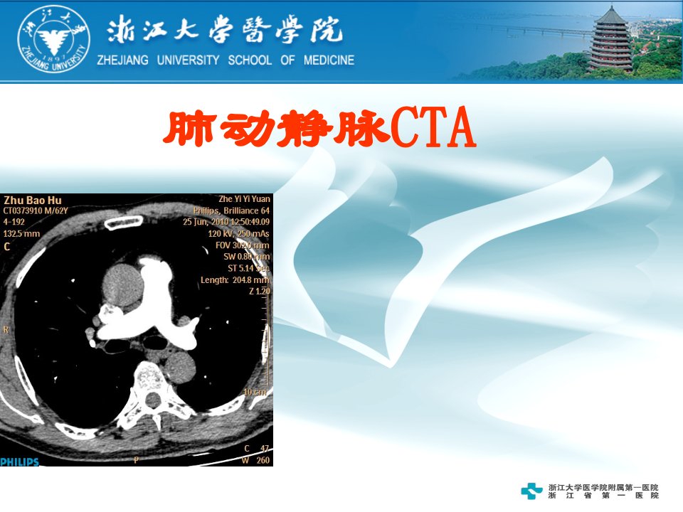 肺动静脉CTA-PPT（荐）