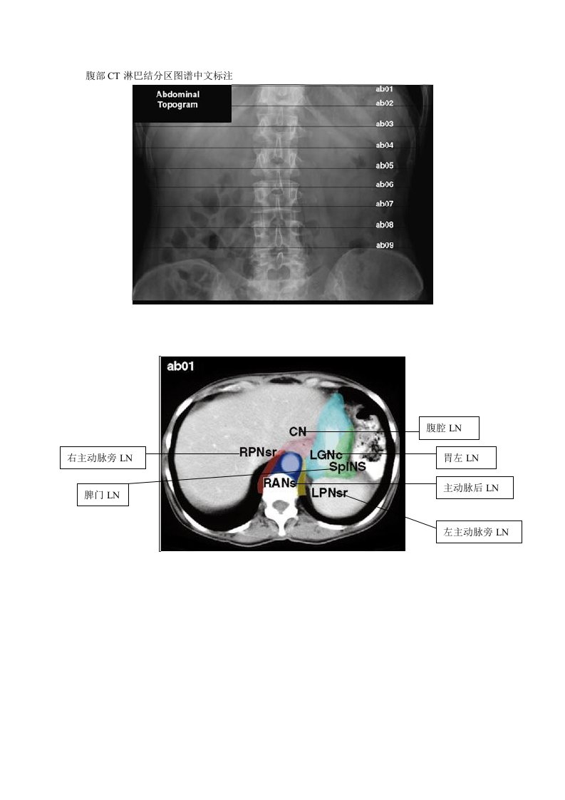 腹部ct淋巴结分区图谱(中文标注)