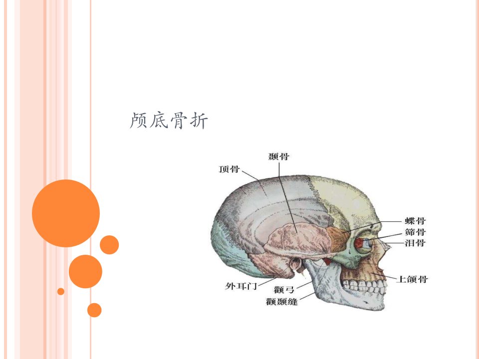 颅底骨折护理标准