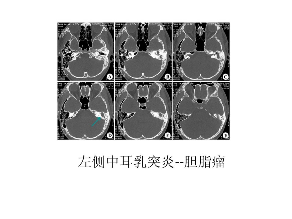 临床医学影像检查课件