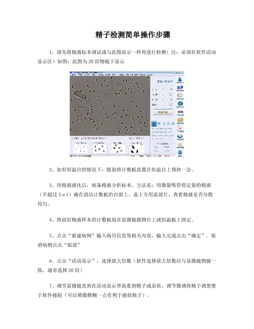 精子动态简单操作步骤及流程图