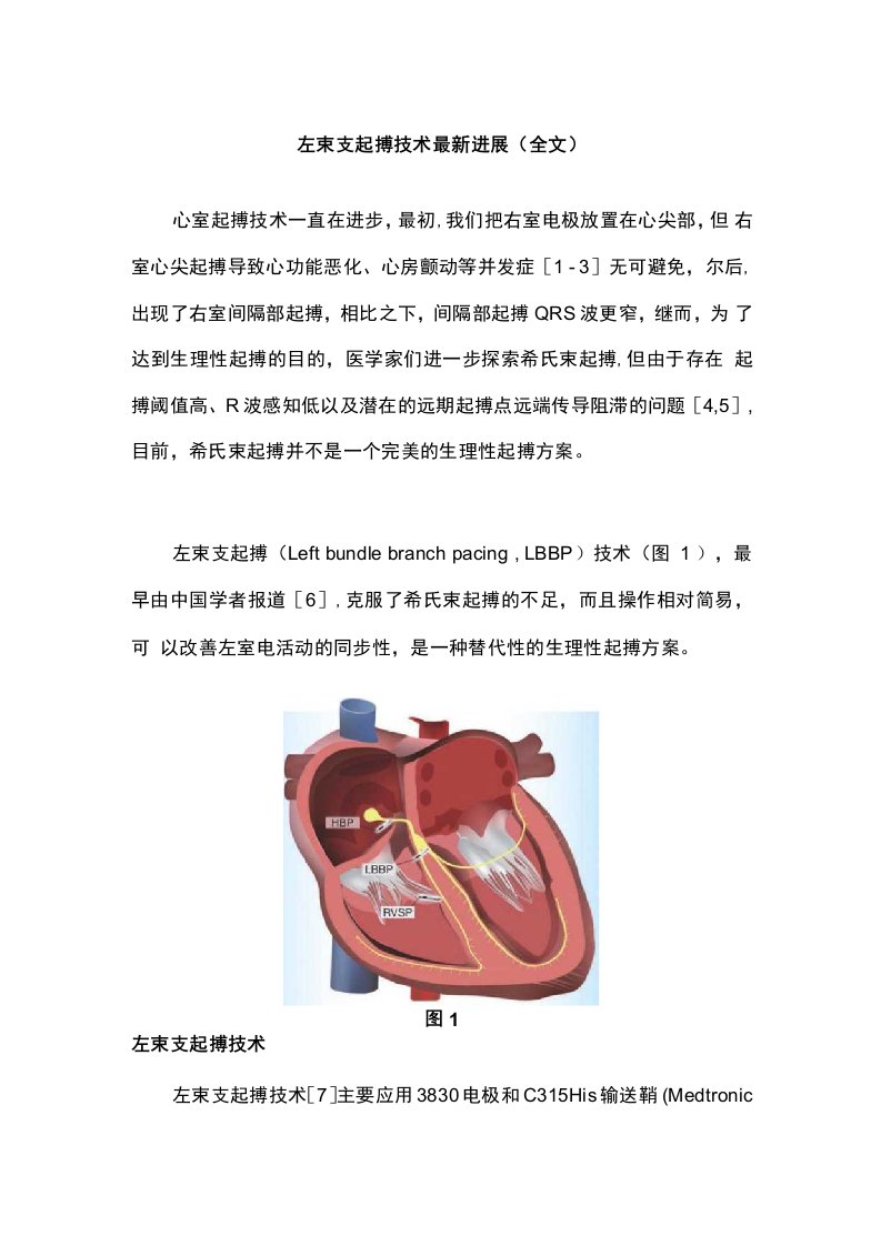 左束支起搏技术进展全文