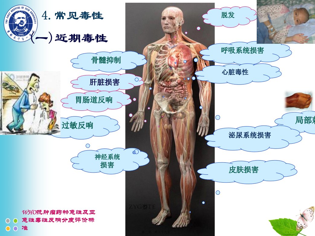 ZCZ化疗常见毒副反应及处理