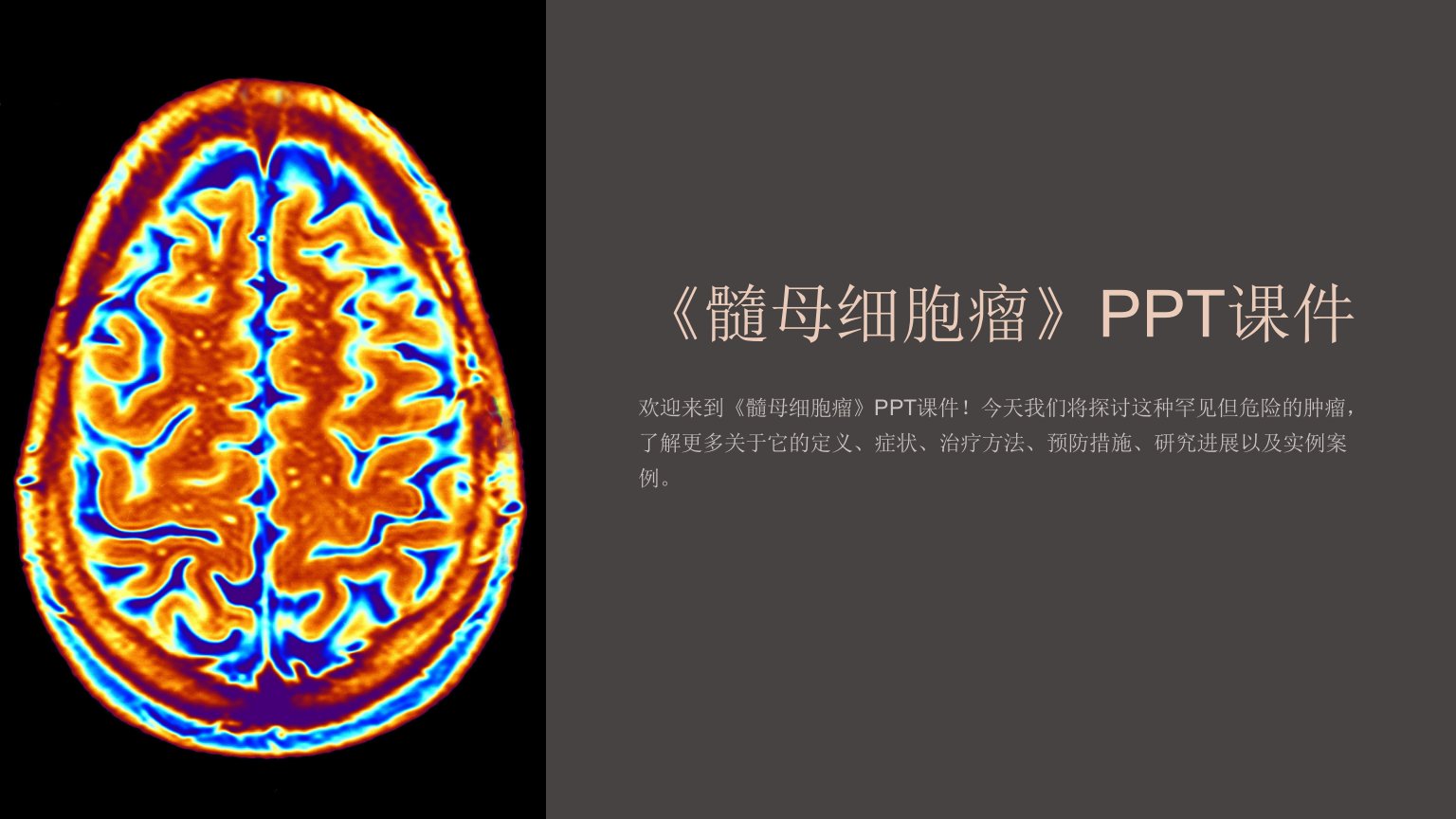 《髓母细胞瘤》课件