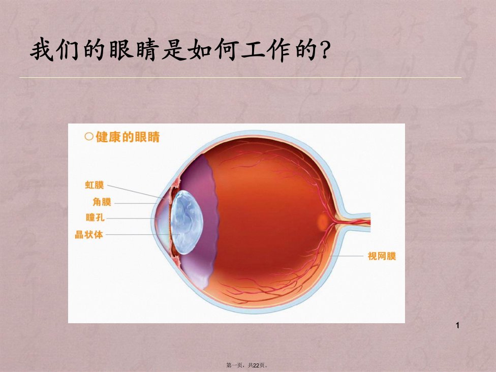 白内障知识培训