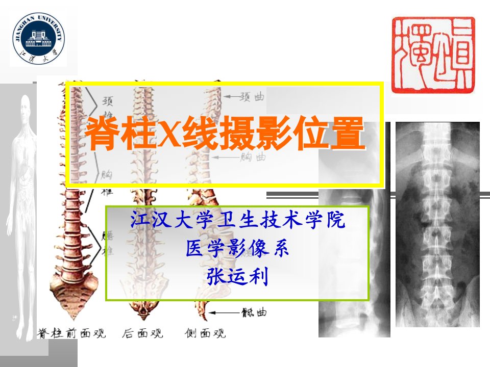 脊柱x线摄影位置