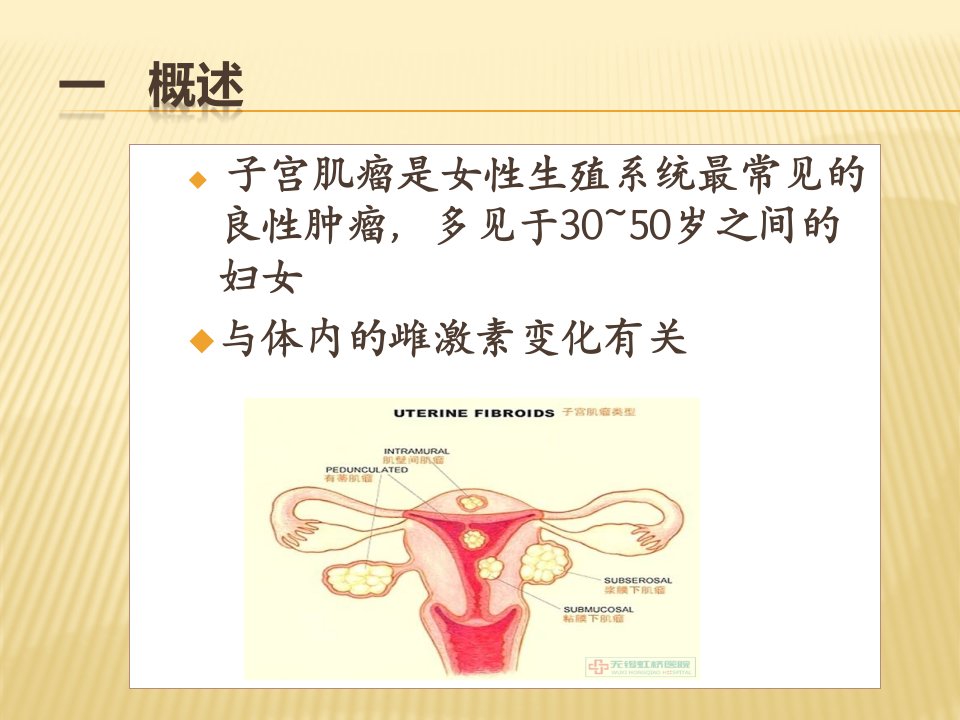 子宫肌瘤及妇科腹部病人的护理课件