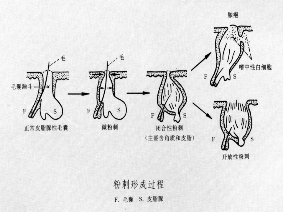 皮肤附属器与色素性疾病