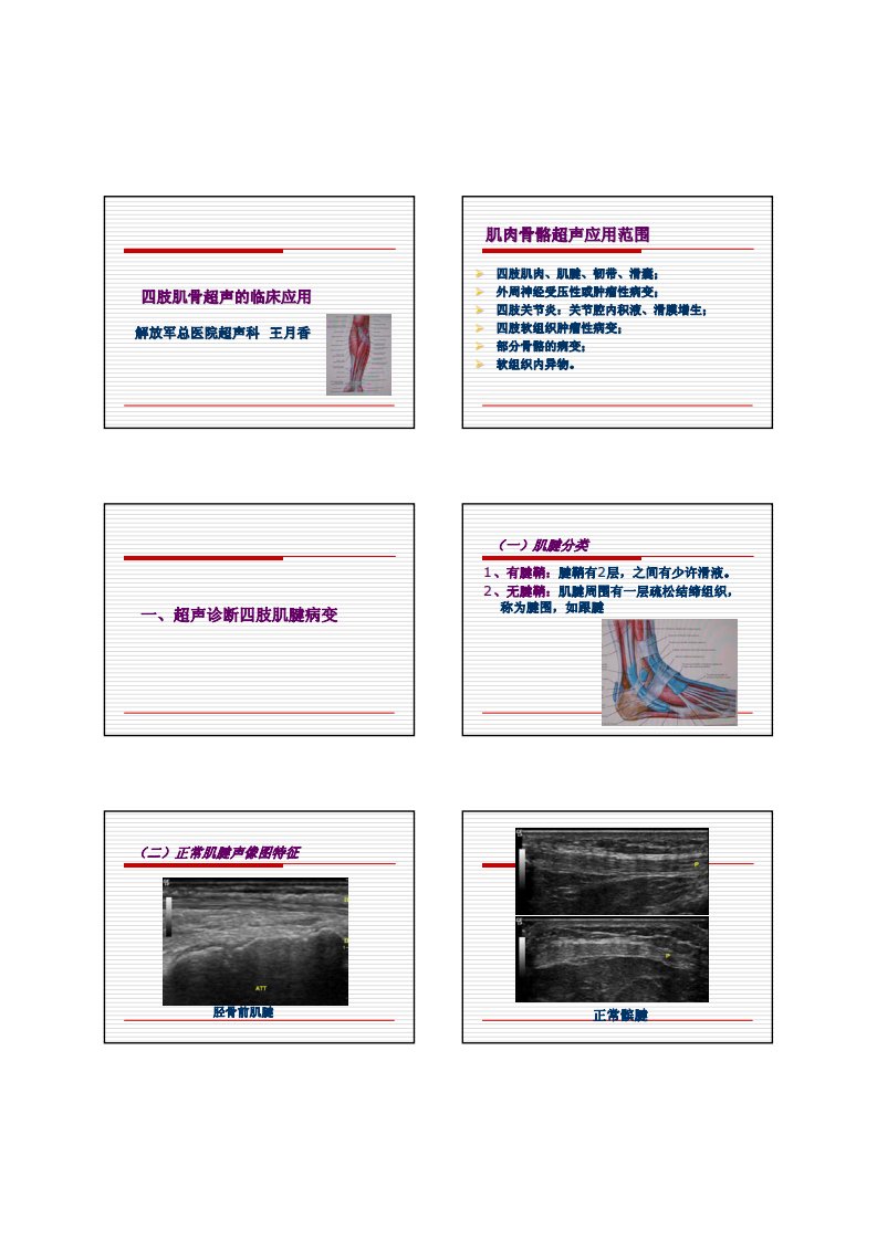 王月香-四肢肌骨头超声的临床应用