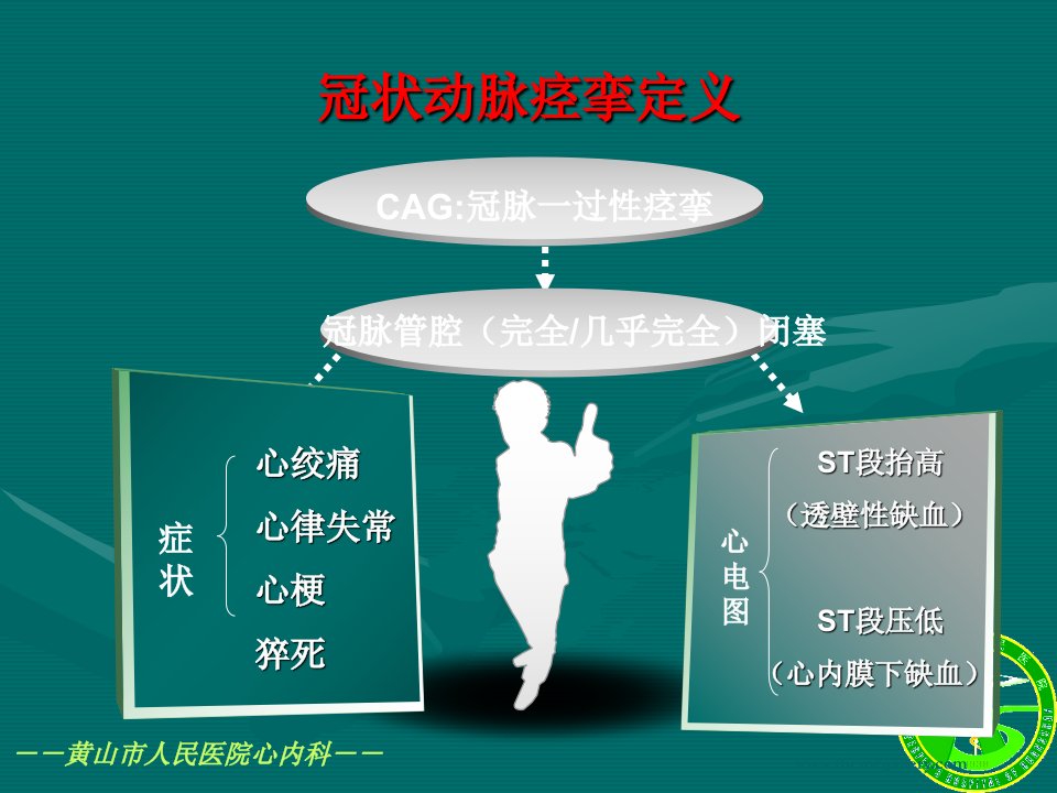 医学专题血管痉挛性心绞痛变异型心绞痛分析