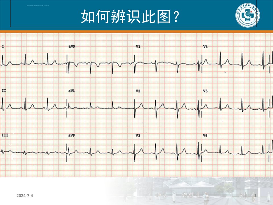 杏树林讲座正确识别心电图ppt课件