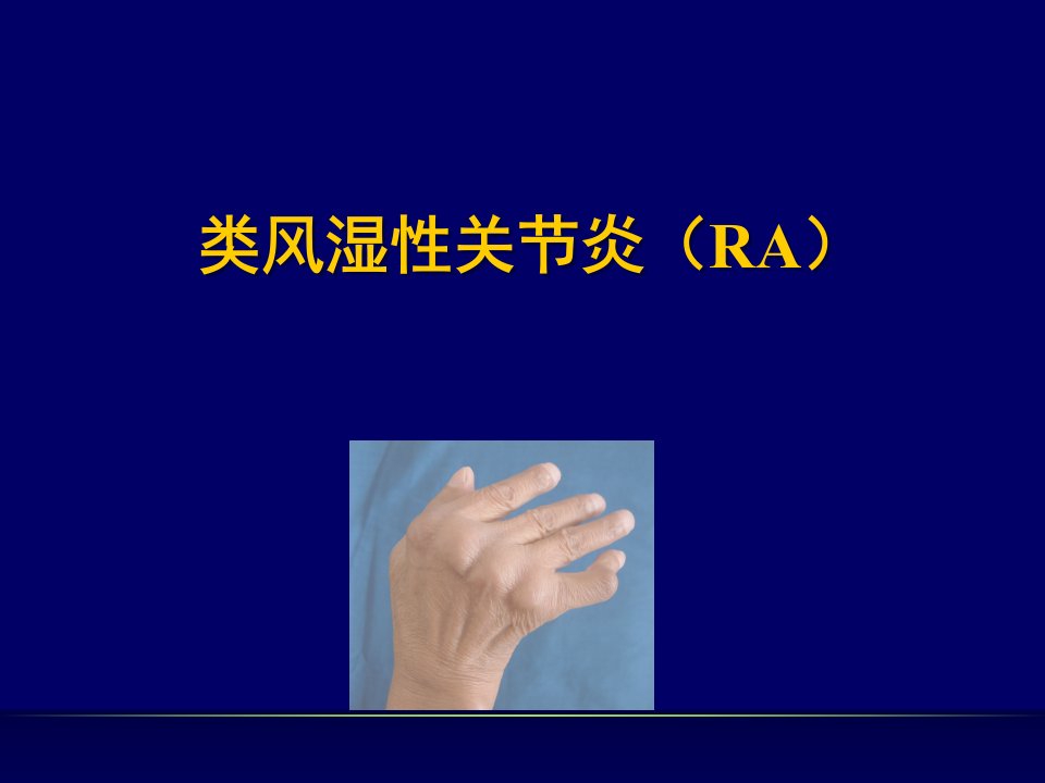 内科学课件类风湿性关节炎