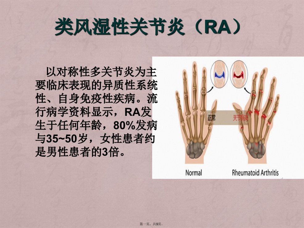 类风湿性关节炎的健康教育