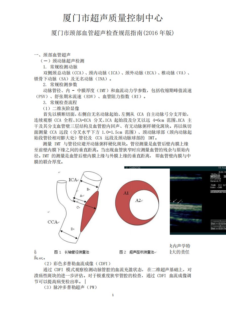 颈部血管超声检查规范指南