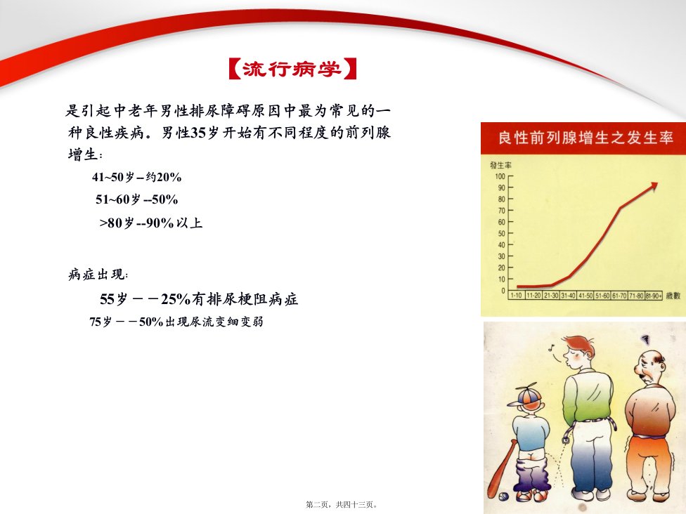 前列腺增生症.PPT