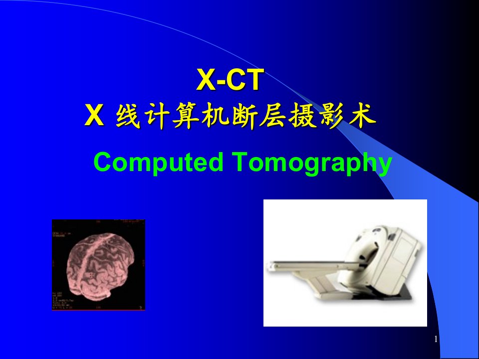 X-CTX线计算机断层摄影术课件