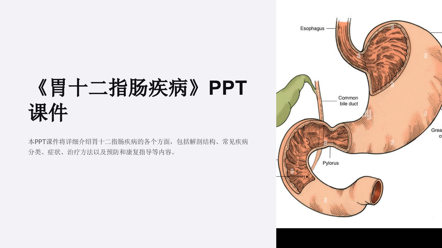 《胃十二指肠疾病》课件