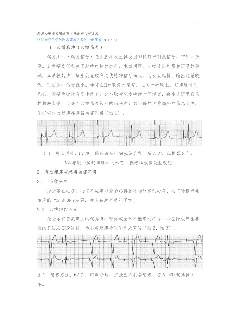 起搏心电图常用的基本概念和心电现象