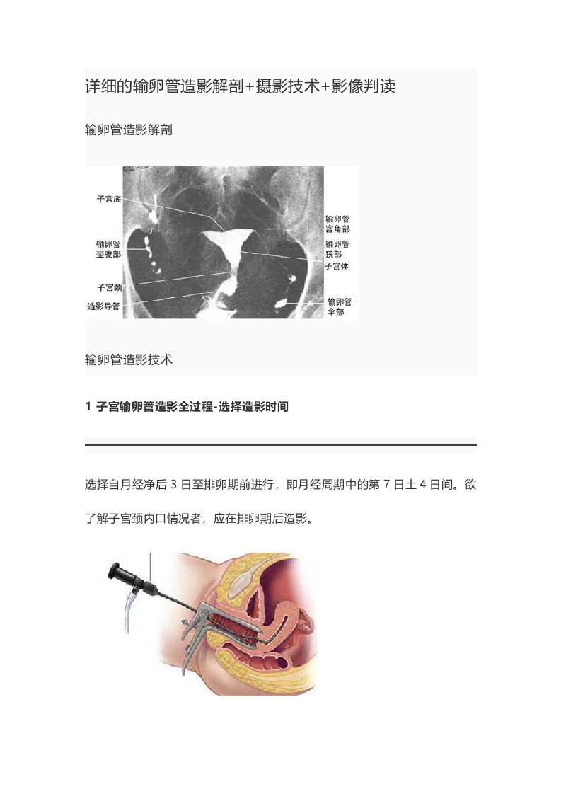 详细的输卵管造影解剖+摄影技术+影像判读