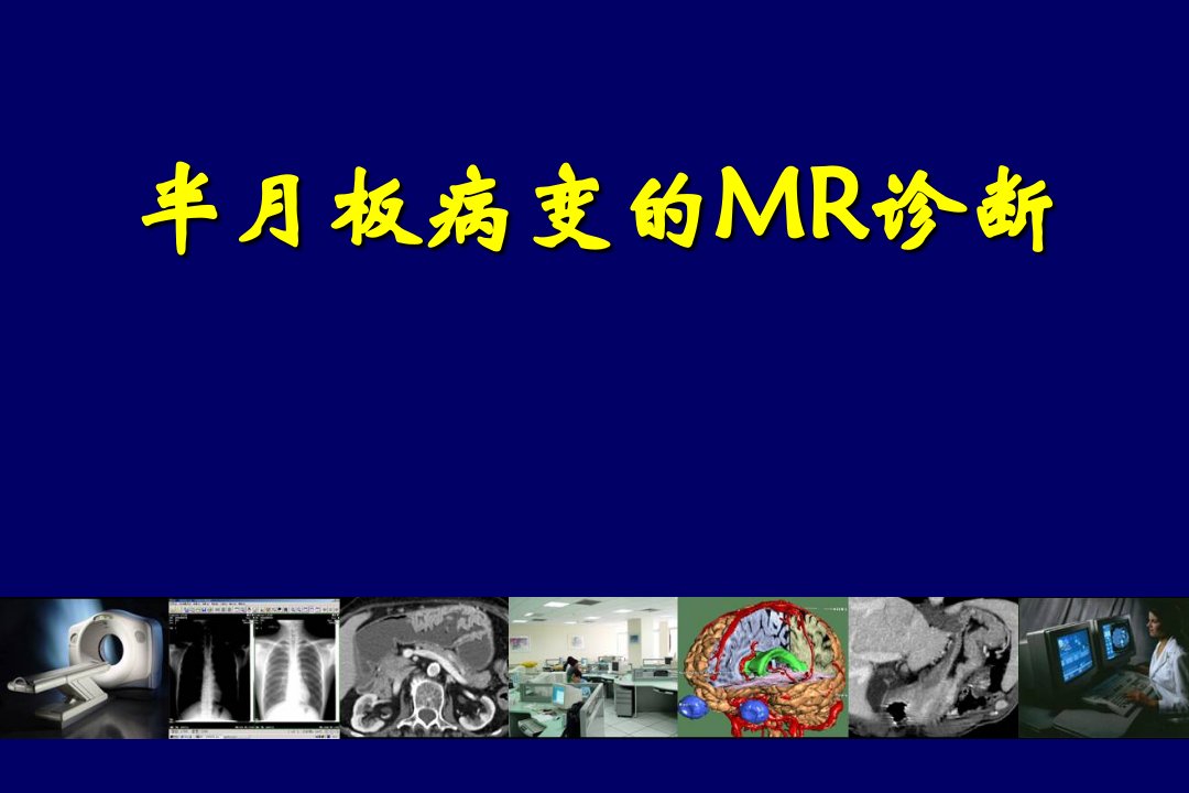 医学影像诊断图文详解完整版-膝关节半月板病变MR诊断课件