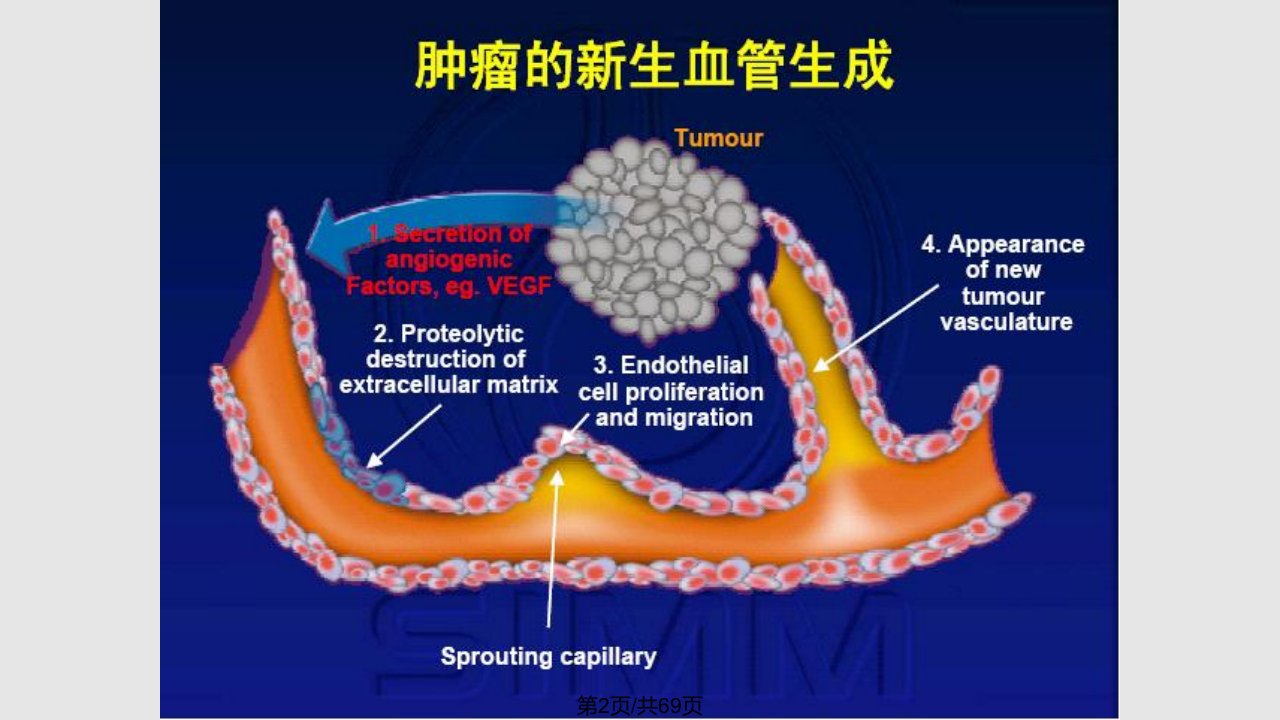 肿瘤抗血管生成治疗