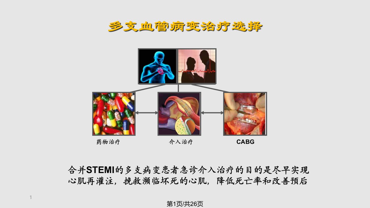 合并多支血管病变STEMI介入治疗策略PPT课件