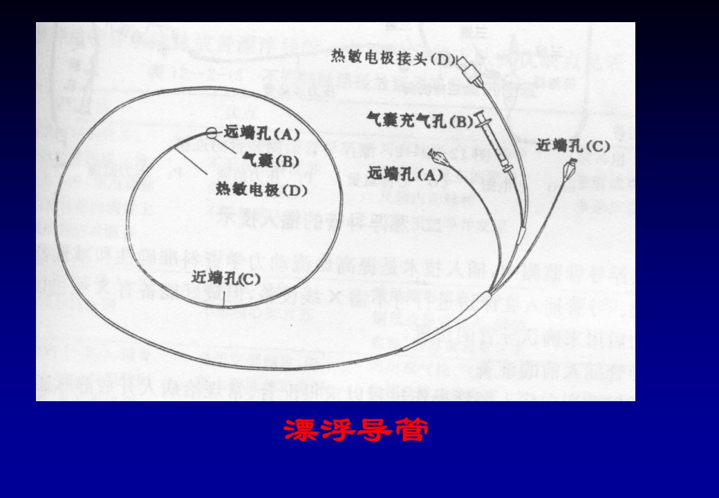 《心脏介入治疗》ppt课件