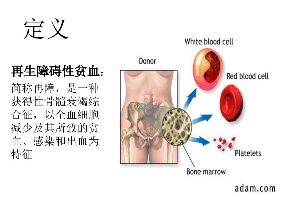 再生障碍性贫血ppt七年制课件