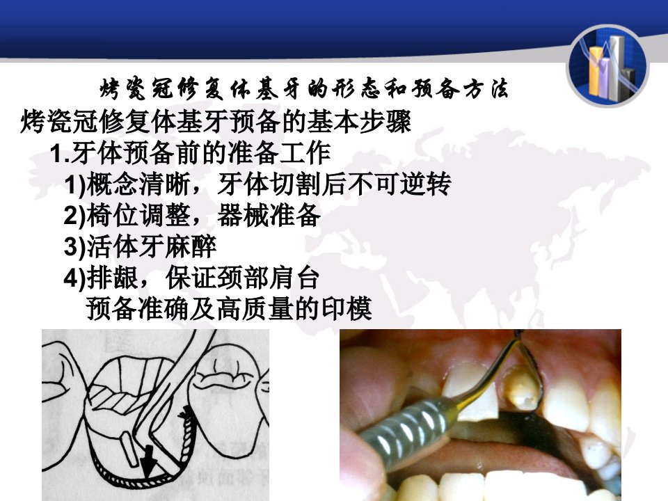 烤瓷冠修复体基牙的形态和预备方法