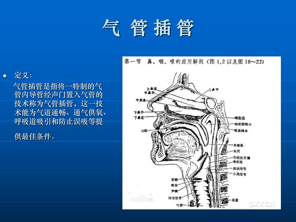 气管插管术pptppt课件