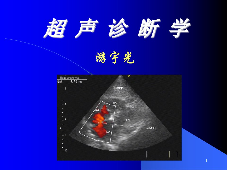 超声诊断学-02基础和原理游宇光